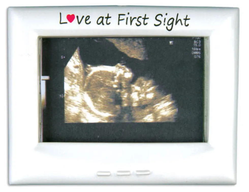 3" Ultrasound Frame Customizable Ornament
